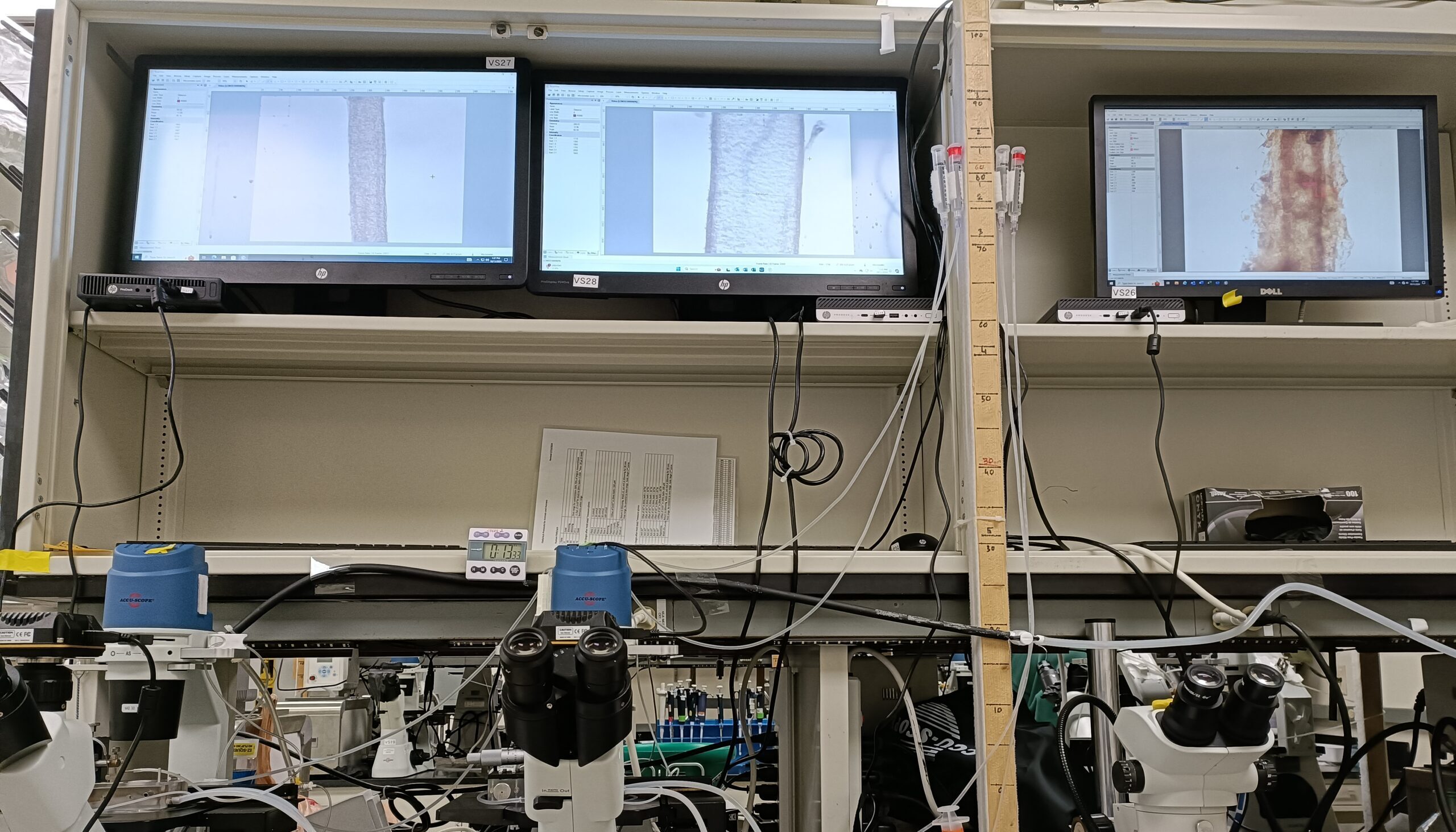 Learning to Experiment with Blood Vessels